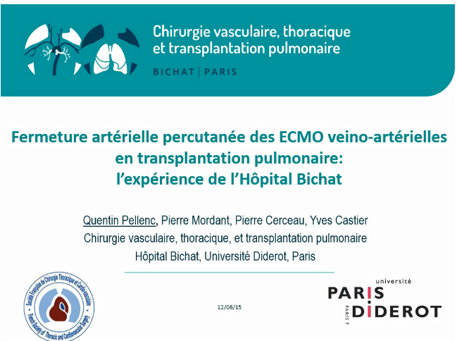 Fermeture artrielle percutané des ECMO veino artrielles