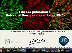 Fibrose pulmonaire : miRNA une cible thérapeutique dans la fibrose