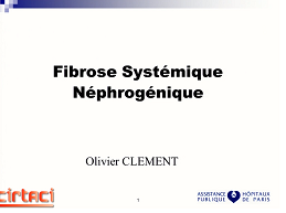 Fibrose systémique néphrogénique Fibrose systémique néphrogénique
