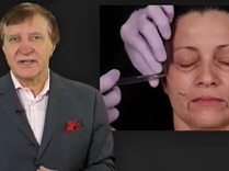 Fillers and Facial Movement. Plastic Surgery Hot Topics with Rod J. Rohrich, MD Fillers and Facial Movement. Plastic Surgery Hot Topics with Rod J. Rohrich, MD