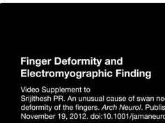 Finger Deformity and Electromyographic Finding Finger Deformity and Electromyographic Finding