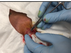finger pus drainage and medical minute - Double Feature