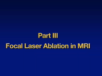 Focal Laser Ablation: Path to a clinic treatment for prostate cancer