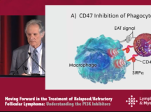 Follicular Lymphoma Debate: Chemotherapy no Longer Has a Major Role in the Treatment Follicular Lymphoma Debate: Chemotherapy no Longer Has a Major Role in the Treatment