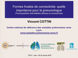 Formes frustes de connectivite, quelle importance pour le pneumologue ?