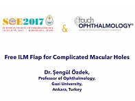 Free ILM Flap for Complicated Macular Holes, Sengul Ozdek