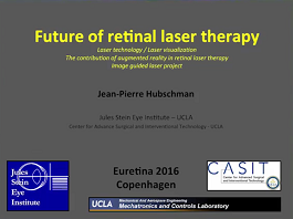 Future of Retinal Laser Therapy