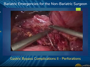 Gastric Bypass Complications II - Perforations