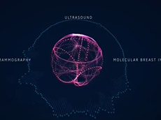 GE Healthcares SenoBright Contrast-Enhanced Spectral Mammography GE Healthcares SenoBright Contrast-Enhanced Spectral Mammography