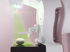 GE Healthcare Senographe Crystal Nova Digital Mammography GE Healthcare Senographe Crystal Nova Digital Mammography