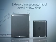 GE Healthcare X-ray: Helix Advanced Image Processing