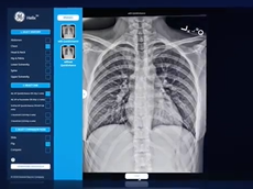 GE Healthcare X-ray: Introducing Helix Clinical Image Comparator (QuickEnhance) GE Healthcare X-ray: Introducing Helix Clinical Image Comparator (QuickEnhance)
