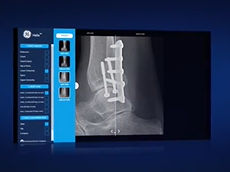GE Healthcare X-ray: Introducing Helix Clinical Image Comparator