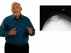 GE Healthcare X-ray: XR Clinically Speaking Podcast OrthoCarolina