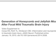 Generation of Honeycomb and Jellyfish Microglia After Focal Mild Traumatic Brain Injury (mTBI) Generation of Honeycomb and Jellyfish Microglia After Focal Mild Traumatic Brain Injury (mTBI)