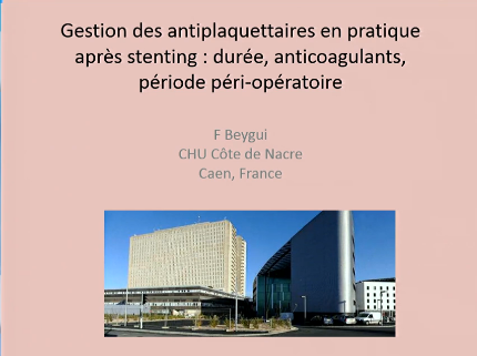 Gestion des antiplaquettaires en pratique après stenting dur