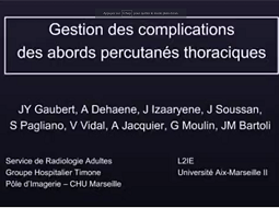 Gestion des complications des abords percutanés thoraciques Gestion des complications des abords percutanés thoraciques