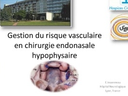 Gestion du risque vasculaire en chirurgie endoscopique hypophysaire