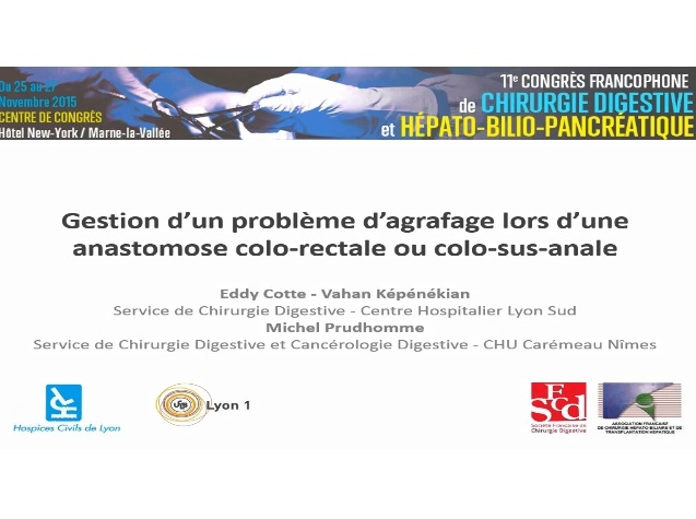 Gestion d'un problème d'agrafage lors d'une anastomose colo-rectale ou colo-sus-anale Gestion d'un problème d'agrafage lors d'une anastomose colo-rectale ou colo-sus-anale