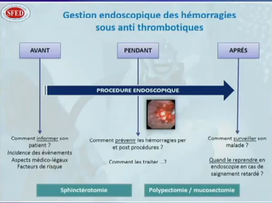 Gestion endoscopique du risque hémorragique sous anti-thrombotiques Gestion endoscopique du risque hémorragique sous anti-thrombotiques