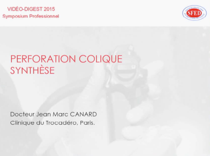 Gestion légale et médico-légale de la perforation colique : synthèse Gestion légale et médico-légale de la perforation colique : synthèse