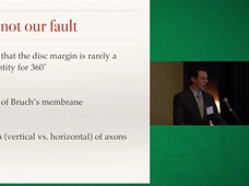 Glaucoma detection using SD-OCT