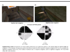 Glaucoma Disability During Virtual Reality (VR) Stair Navigation Glaucoma Disability During Virtual Reality (VR) Stair Navigation