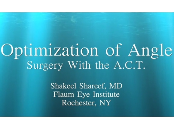 Glaucoma - Optimization of Angle Surgery With the A.C.T. (Anesthesia, Control, Timing) Glaucoma - Optimization of Angle Surgery With the A.C.T. (Anesthesia, Control, Timing)