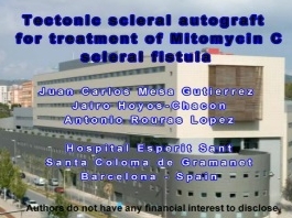 Glaucome - Autogreffe sclérale tectonique pour le traitement de la fistule sclérale à Mitomycine C Glaucome - Autogreffe sclérale tectonique pour le traitement de la fistule sclérale à Mitomycine C