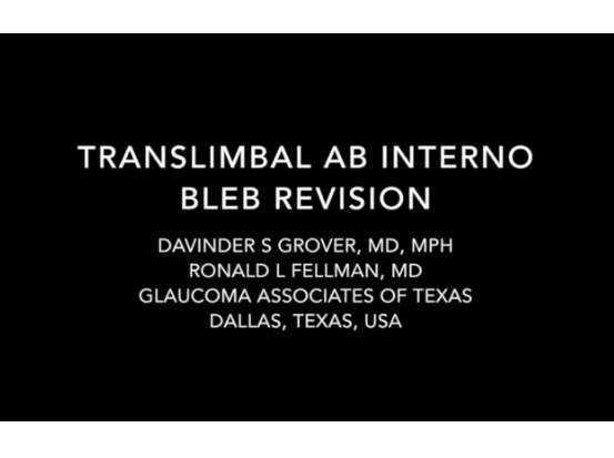 Glaucoma -  Translimbal Ab Interno Bleb Revision