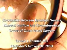Glaucome - Corrélation entre un efflux veineux épiscléral et la circonférence d'une chirurgie canal-based Glaucome - Corrélation entre un efflux veineux épiscléral et la circonférence d'une chirurgie canal-based