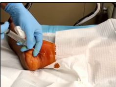 Égout ce pied! Dr ER Surgical Review