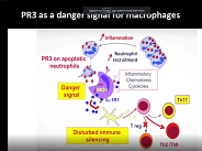 Granulomatose avec polyangéite (Wegener)