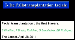 Greffe de visage, extrapolation à l'enfant et à l'adolescent