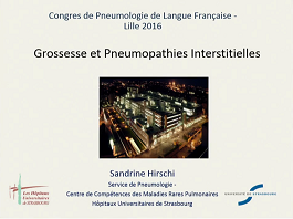 Grossesse et pneumopathie interstitielle diffuse