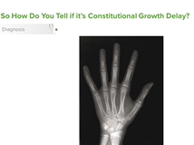 Growth Delay: Diagnosis & Management- Pediatric Endocrinology