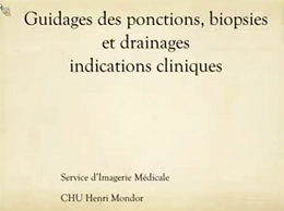 Guidages des ponction, biopsies et drainages. Indication cliniques Guidages des ponction, biopsies et drainages. Indication cliniques