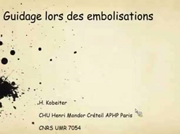 Guidages lors des embolisation Guidages lors des embolisation