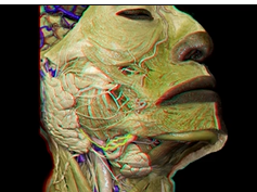 Head and Neck Anatomy for Neurosurgeons (3D Anaglyph)