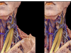 Head and Neck Anatomy for Neurosurgeons (3D TV)