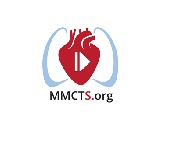 HeartMate 3 left ventricular assist device minimally invasive off-pump implantation HeartMate 3 left ventricular assist device minimally invasive off-pump implantation
