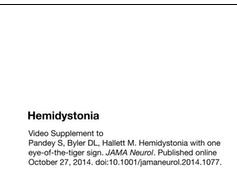 Hemidystonia Hemidystonia