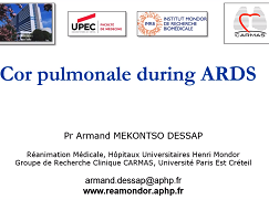 Hemodynamic alterations in ARDS - Prevalence and consequences of acute cor pulmonale Hemodynamic alterations in ARDS - Prevalence and consequences of acute cor pulmonale