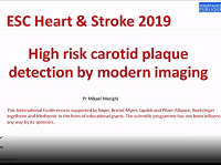 High risk carotid plaque detection by modern imaging