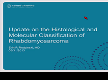 Histology and Fusion Status in Rhabdomyosarcoma Histology and Fusion Status in Rhabdomyosarcoma