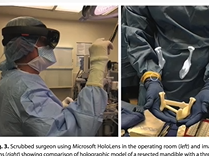 HoloLens in the Operating Room: Plastic Surgery Hot Topics with Rod J. Rohrich, MD HoloLens in the Operating Room: Plastic Surgery Hot Topics with Rod J. Rohrich, MD