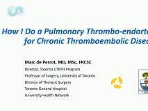 How I Do a Pulmonary Thromboendarterectomy for Chronic Thromboembolic Disease