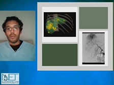 How Much Can Liver Take - Treating with IR - Osmanuddin Ahmed