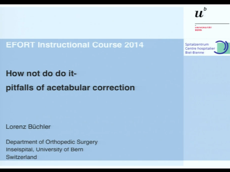 How not to do it - pitfalls of acetabular correction