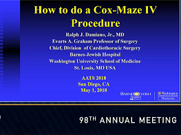 How to do a State of the Art Open Cox Maze IV Operation